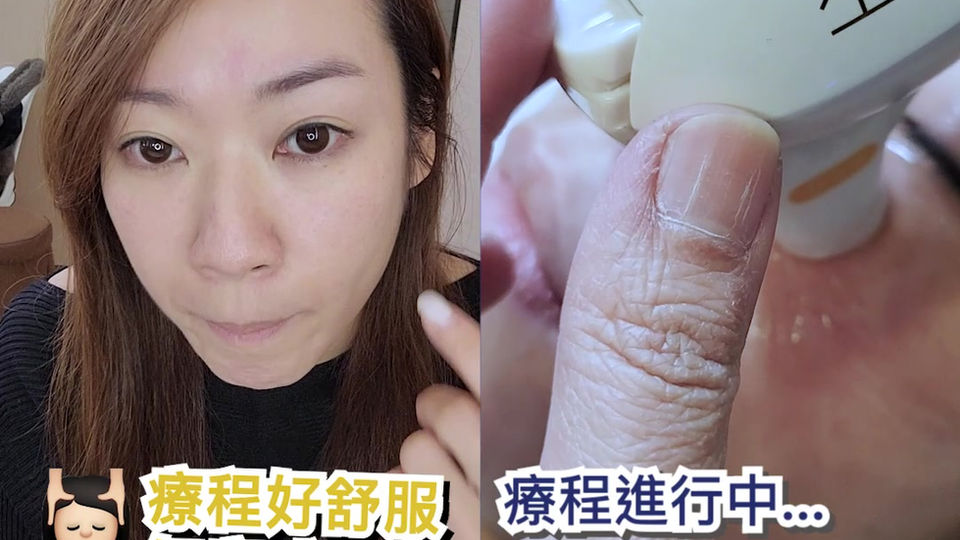溫和速效解決眼部問題